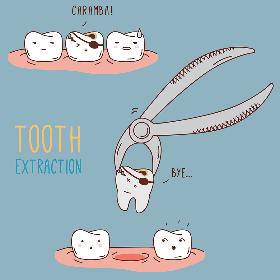 Understanding Oral Surgery for 3rd Molar Extractions in San Diego, CA: What You Need to Know