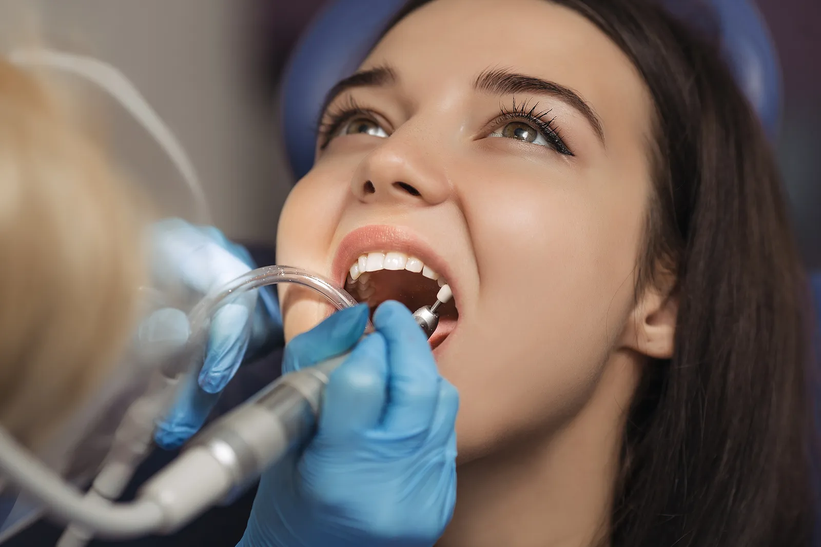 Essential Tips for Root Canal Aftercare: What You Need to Know