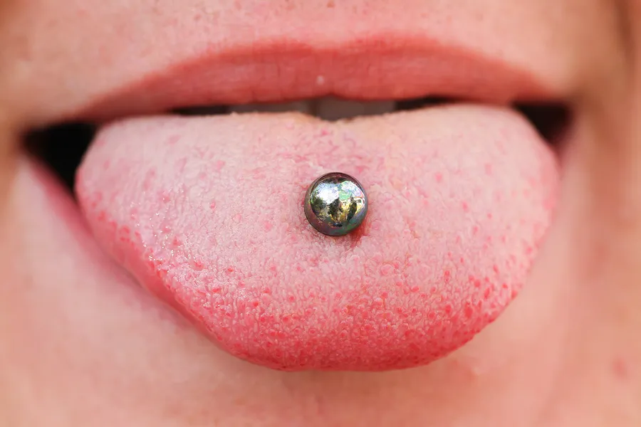 Effects of Tongue Rings and Tongue Piercings On Oral Health