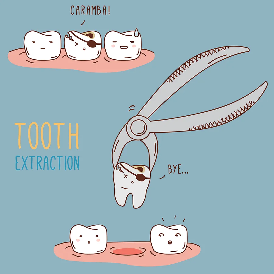 Understanding Oral Surgery for 3rd Molar Extractions: What You Need to Know